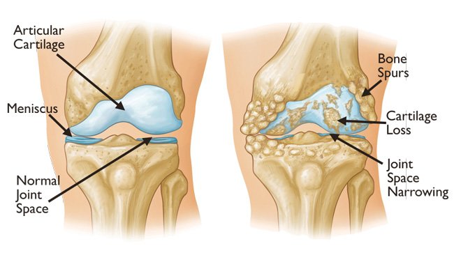 https://orthopedicsurgeon4u.com/